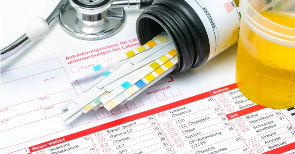 Urinalysis: What Does It Reveal?