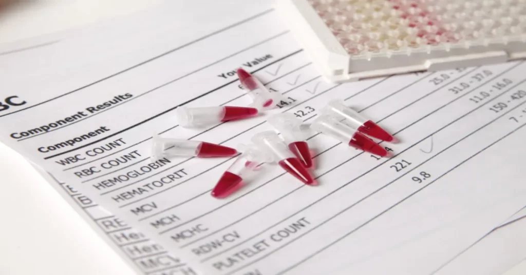 تحليل الدم الشامل ماذا يكشف؟