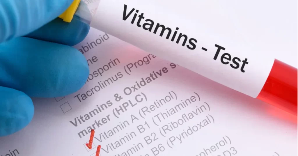 Vitamin levels test: What You Need to Know About the Test