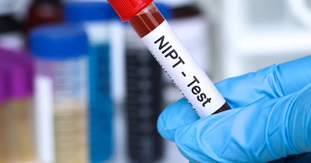What is the NIPT test?