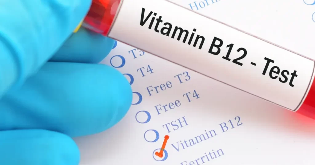 فحص فيتامين B12