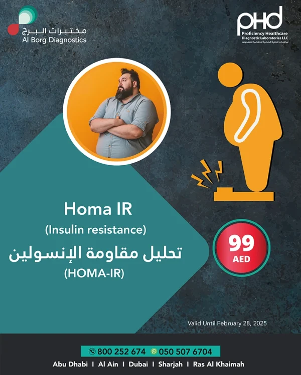 Homa IR (Insulin resistance)